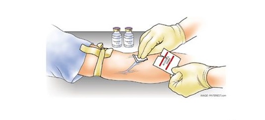 nursing assignment about IV insertion