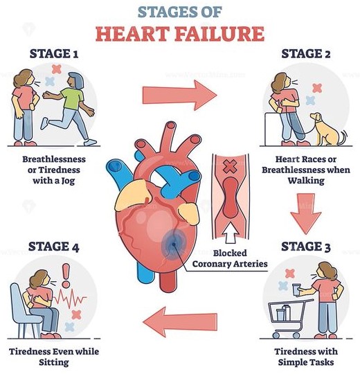nursing case study on a patient with heart failure